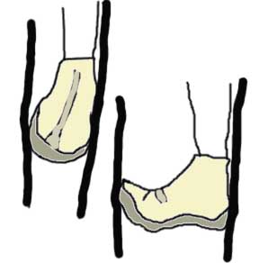 esempi di incastro di piede